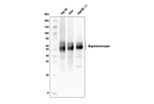 Western Blotting Image 1: Angiotensinogen Antibody