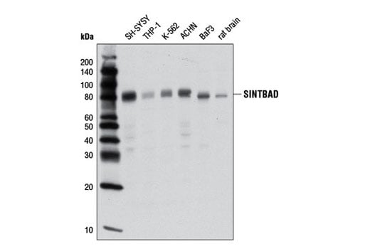 Western Blotting Image 1: SINTBAD (D1A5) Rabbit mAb