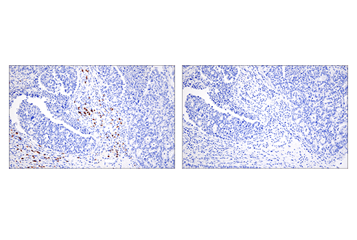 Immunohistochemistry Image 7: CD20 (E7B7T) XP<sup>®</sup> Rabbit mAb