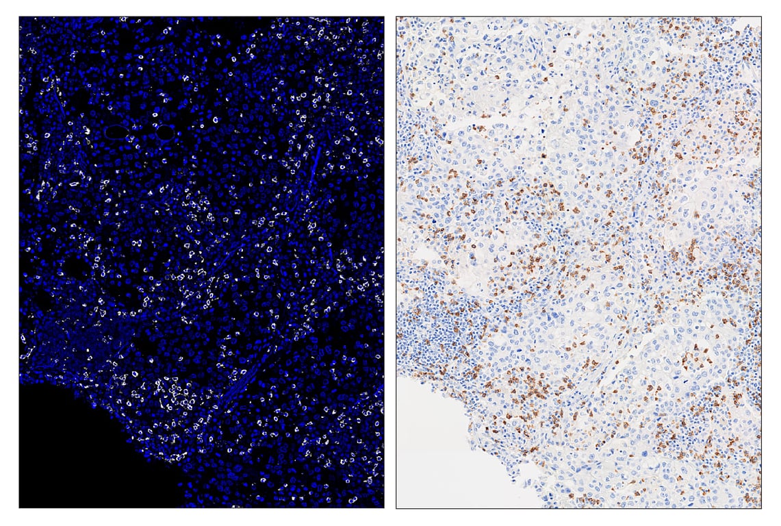Immunohistochemistry Image 6: CD8α (D8A8Y) & CO-0004-647 SignalStar<sup>™</sup> Oligo-Antibody Pair