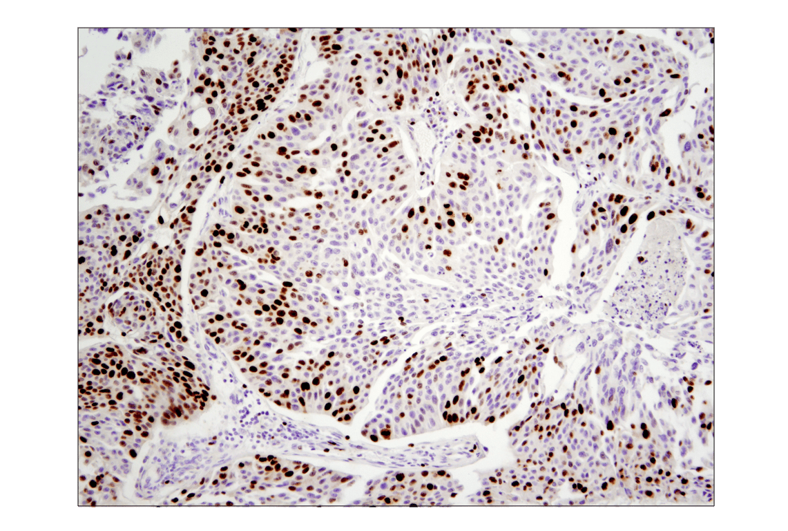 Immunohistochemistry Image 3: Ki-67 (D2H10) Rabbit mAb (BSA and Azide Free)