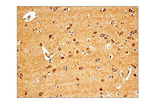 Immunohistochemistry Image 2: APP (E8B3O) XP<sup>®</sup> Rabbit mAb