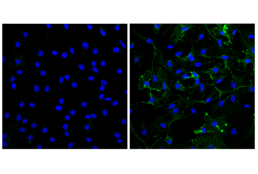Immunofluorescence Image 1: CD38 (E9F5A) XP<sup>®</sup> Rabbit mAb