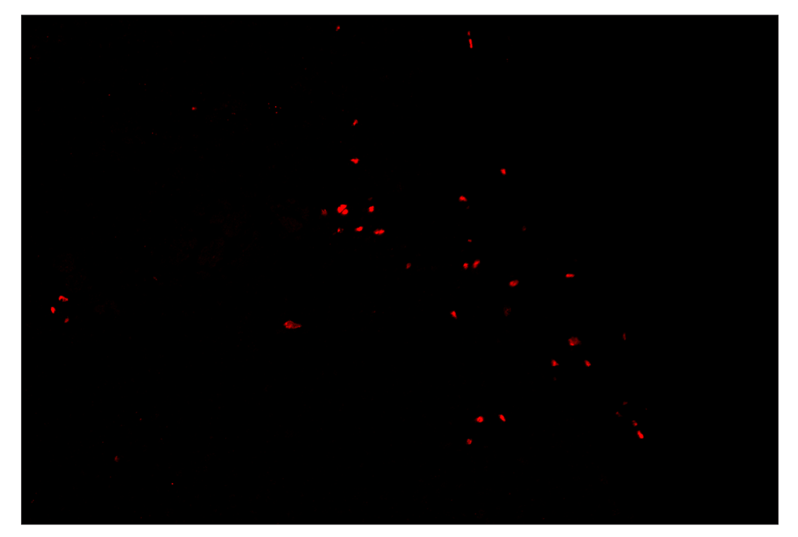 Immunohistochemistry Image 4: FoxP3 (D6O8R) & CO-0041-488 SignalStar<sup>™</sup> Oligo-Antibody Pair