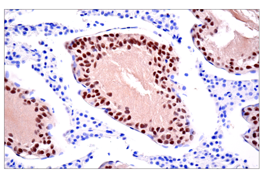 undefined Image 77: Human Exhausted CD8<sup>+</sup> T Cell IHC Antibody Sampler Kit