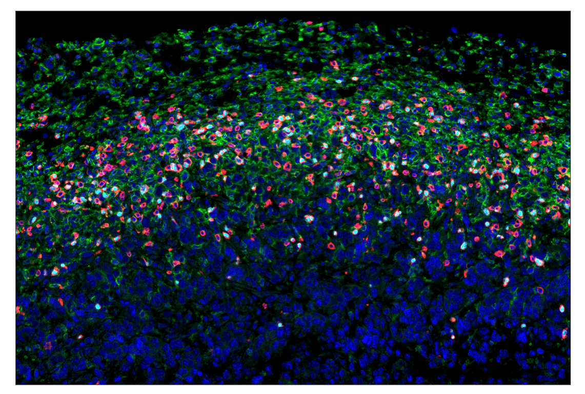 Immunohistochemistry Image 1: FoxP3 (D6O8R) & CO-0041-594 SignalStar<sup>™</sup> Oligo-Antibody Pair