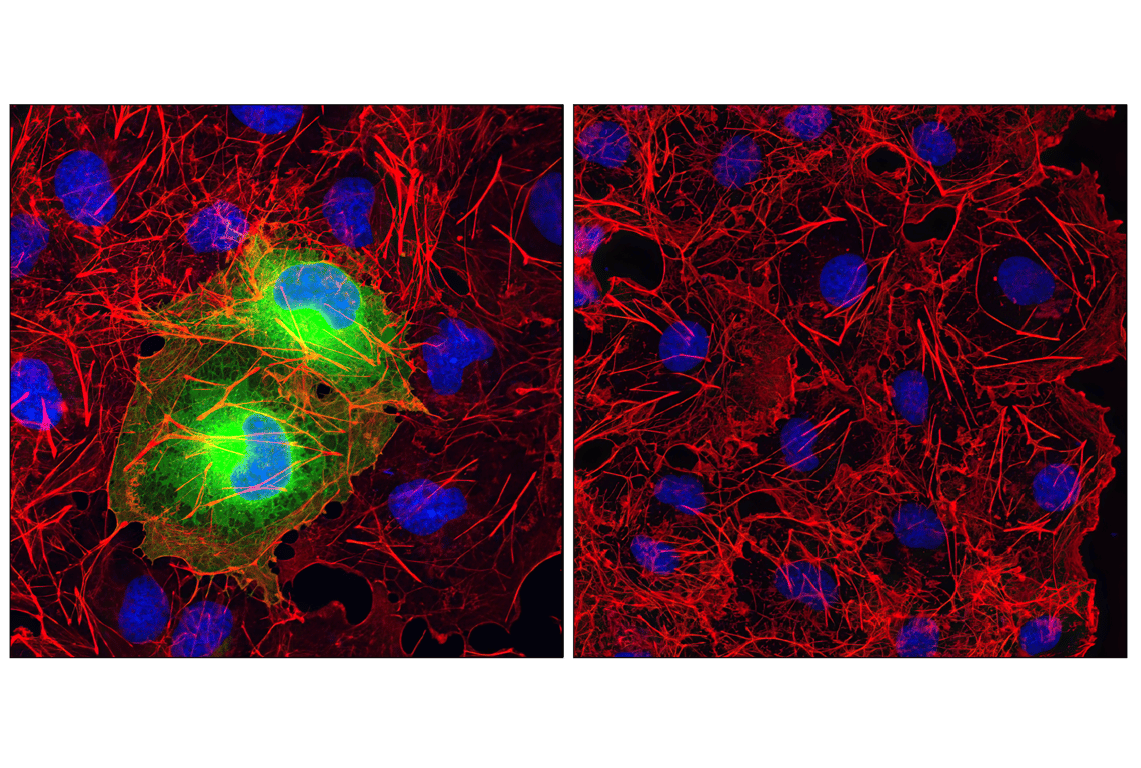 Immunofluorescence Image 1: HA-Tag (C29F4) Rabbit mAb