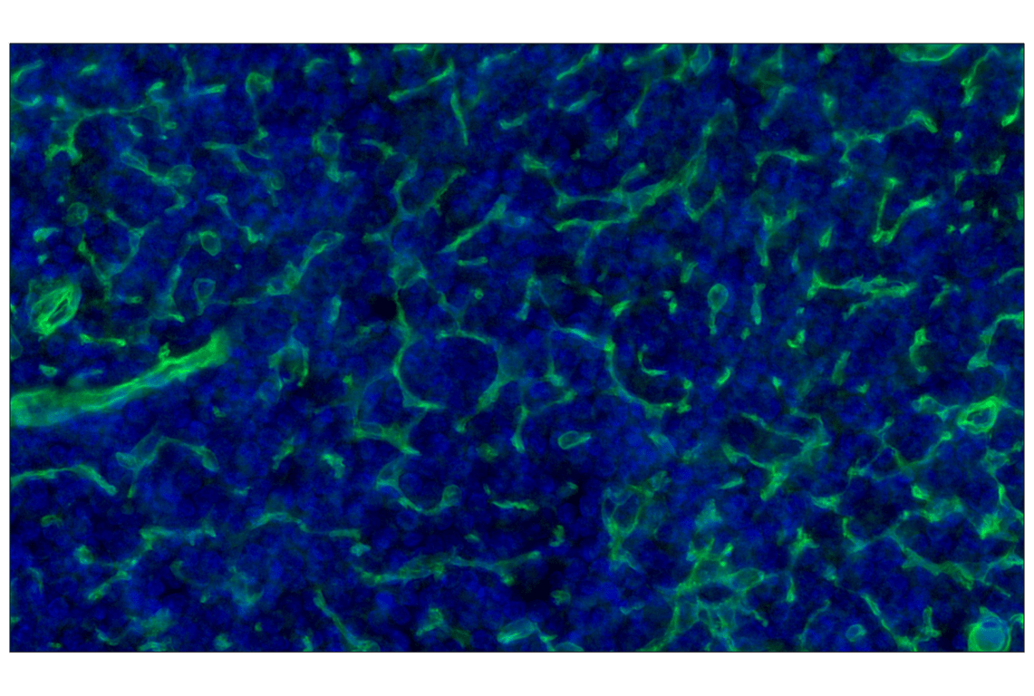 Immunohistochemistry Image 1: CD141/Thrombomodulin (E7Y9P) XP<sup>®</sup> Rabbit mAb (Alexa Fluor<sup>®</sup> 488 Conjugate)