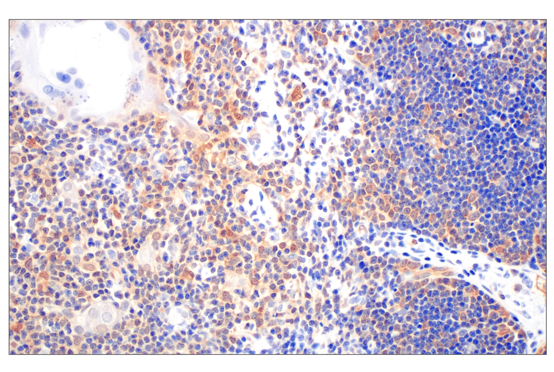 Immunohistochemistry Image 8: Galectin-8/LGALS8 (F9O3T) Rabbit mAb