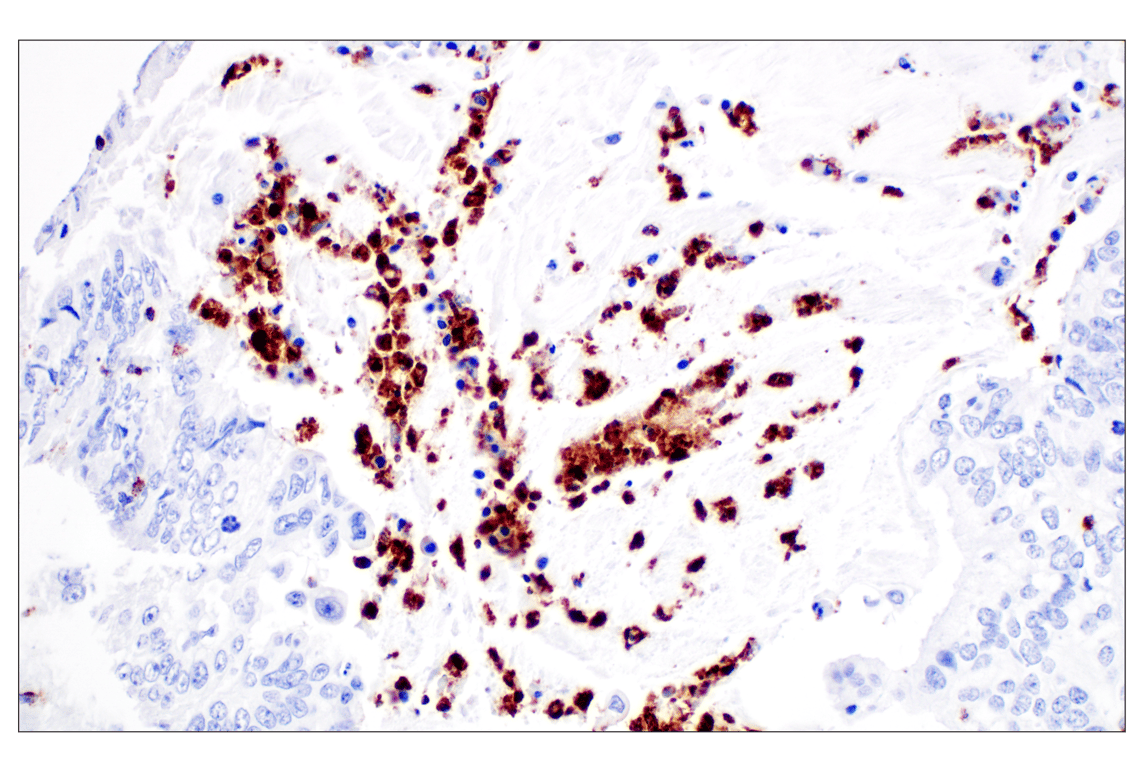 Immunohistochemistry Image 5: NKG7 (F4V5I) Rabbit mAb (BSA and Azide Free)