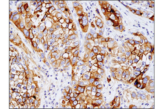 Immunohistochemistry Image 4: Mesothelin (D9R5G) XP<sup>®</sup> Rabbit mAb (BSA and Azide Free)