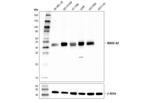 Western Blotting Image 1: MAGE-A3 Antibody