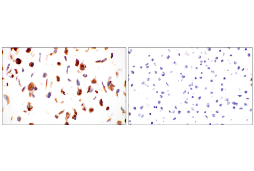 undefined Image 47: Extracellular Matrix Dynamics Antibody Sampler Kit
