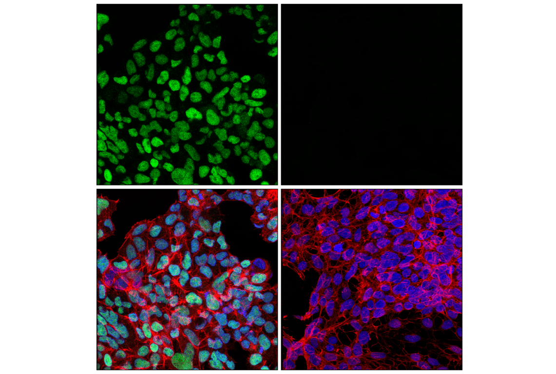 Immunofluorescence Image 1: DLX1 (E4T1L) Rabbit mAb