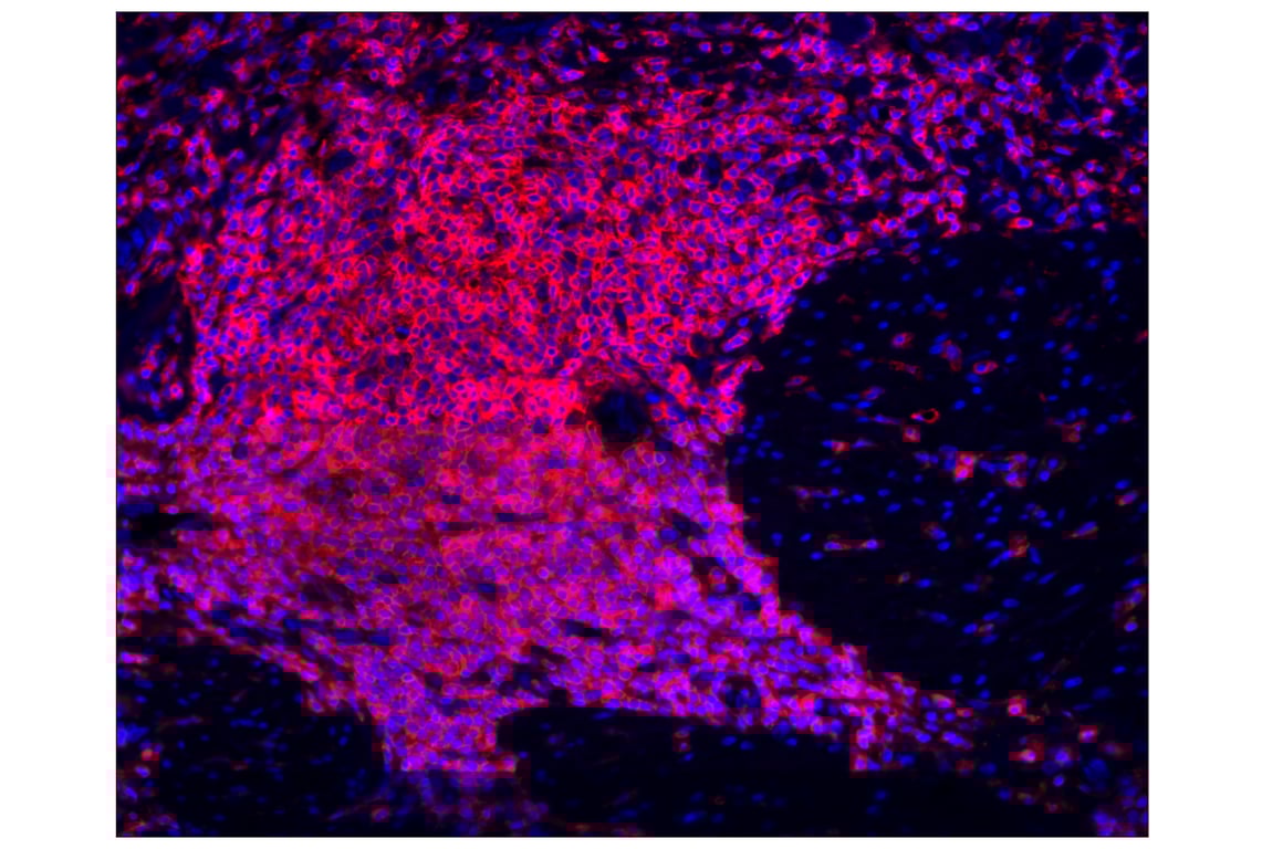 Immunohistochemistry Image 1: CD45 (Intracellular Domain) (D9M8I) XP<sup>®</sup> Rabbit mAb (Alexa Fluor<sup>®</sup> 555 Conjugate)