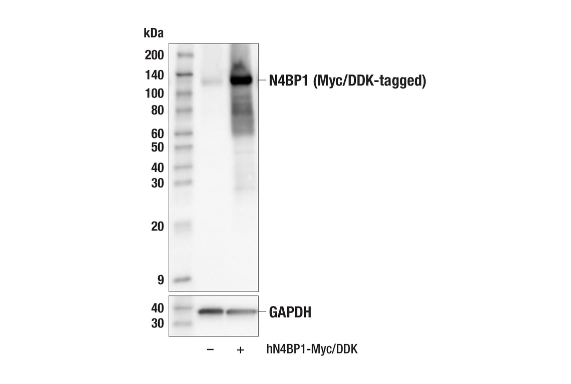 Western Blotting Image 1: N4BP1 (E8H5E) Rabbit mAb