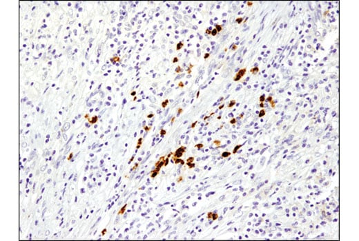 Immunohistochemistry Image 4: MMP-9 (D6O3H) XP<sup>®</sup> Rabbit mAb (BSA and Azide Free)