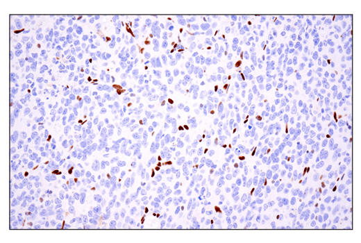 undefined Image 66: Epithelial-Mesenchymal Transition (EMT) IF Antibody Sampler Kit