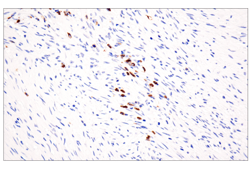 Immunohistochemistry Image 3: CD20 (E7B7T) XP<sup>®</sup> Rabbit mAb (BSA and Azide Free)