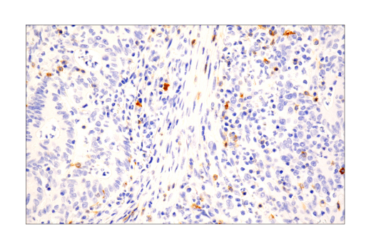 Immunohistochemistry Image 4: TNFRSF8/CD30 (E7E4D) XP<sup>®</sup> Rabbit mAb