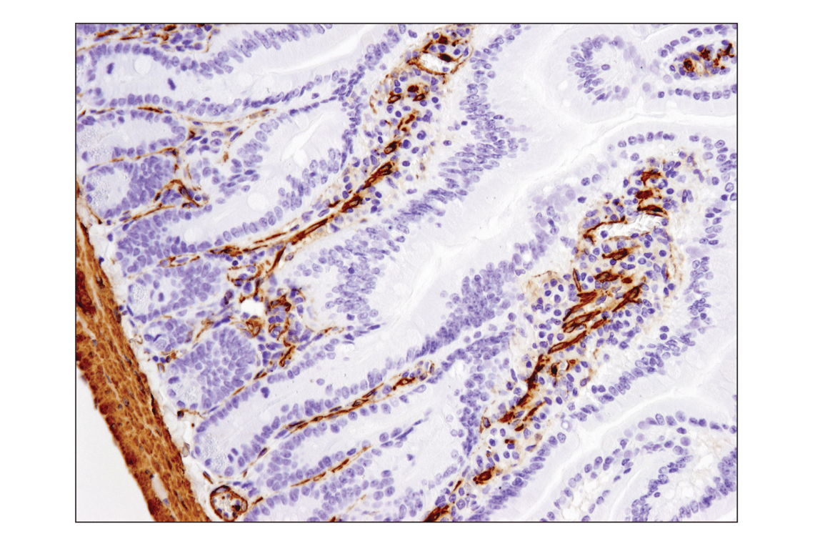 Immunohistochemistry Image 6: α-Smooth Muscle Actin (D4K9N) XP<sup>®</sup> Rabbit mAb (BSA and Azide Free)