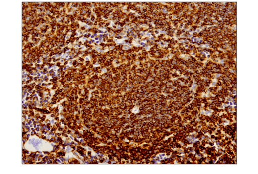Immunohistochemistry Image 3: CD45 (D3F8Q) Rabbit mAb