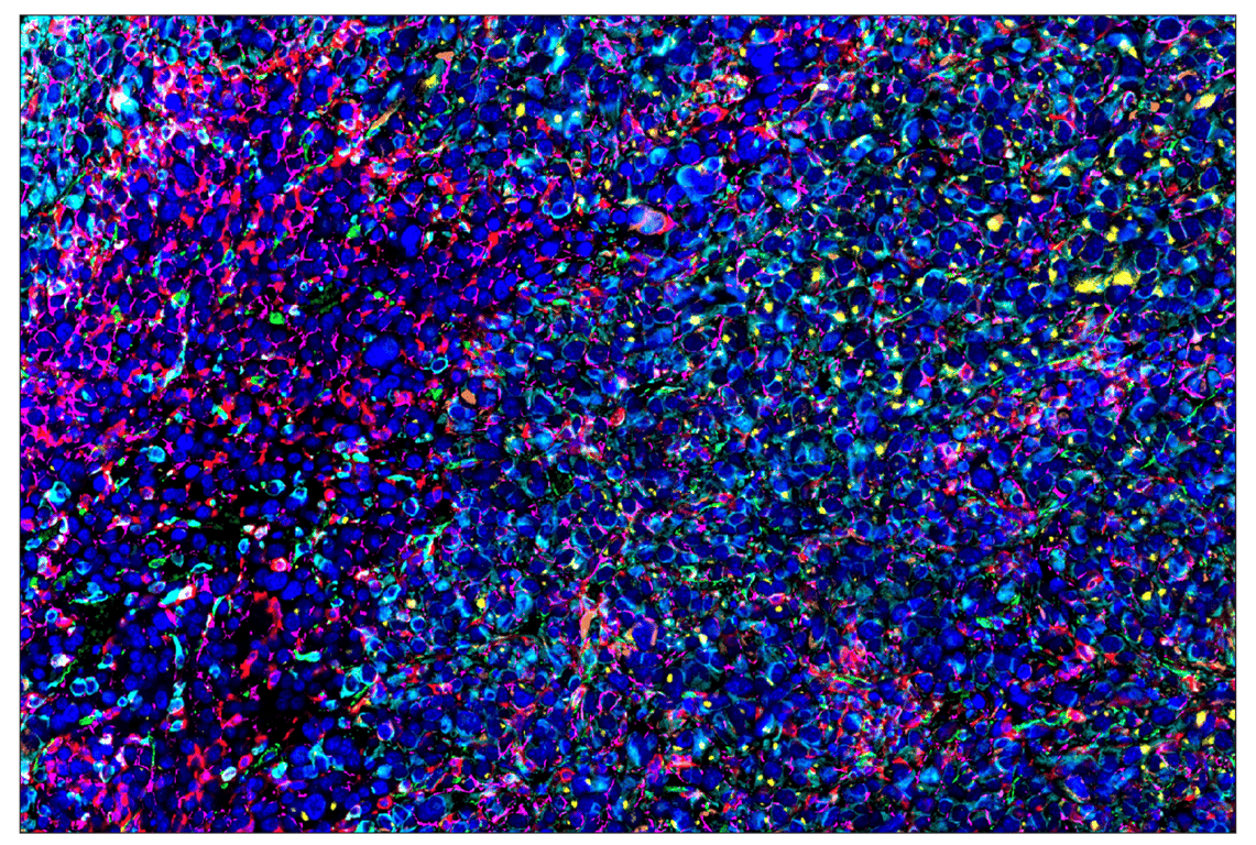 Immunohistochemistry Image 1: CD206/MRC1 (E6T5J) & CO-0032-594 SignalStar<sup>™</sup> Oligo-Antibody Pair