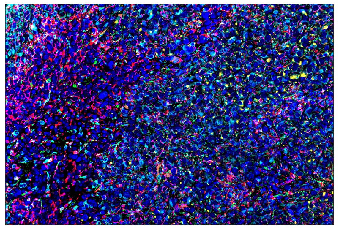 Immunohistochemistry Image 1: CD206/MRC1 (E6T5J) & CO-0032-647 SignalStar™ Oligo-Antibody Pair