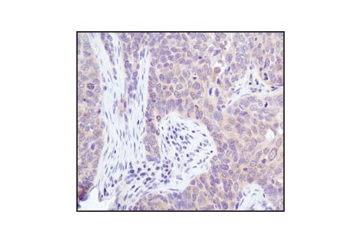 Immunohistochemistry Image 2: Akt (pan) (11E7) Rabbit mAb