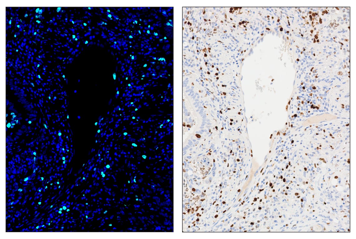 Immunohistochemistry Image 6: Ki-67 (8D5) & CO-0014-647 SignalStar<sup>™</sup> Oligo-Antibody Pair