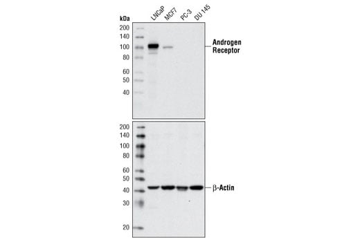 Western Blotting Image 1: Androgen Receptor (D6F11) XP<sup>®</sup> Rabbit mAb (Biotinylated)