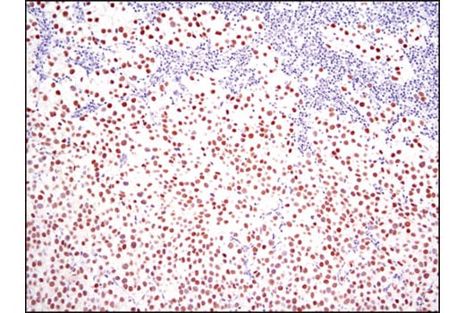 Immunohistochemistry Image 1: Nanog (D73G4) XP<sup>®</sup> Rabbit mAb