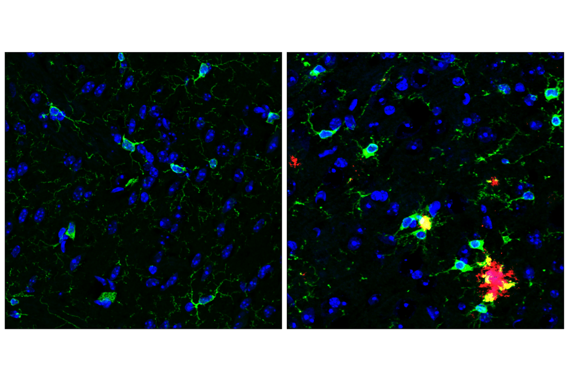 Immunofluorescence Image 1: HS1 (D5A9) XP<sup>®</sup> Rabbit mAb (BSA and Azide Free)