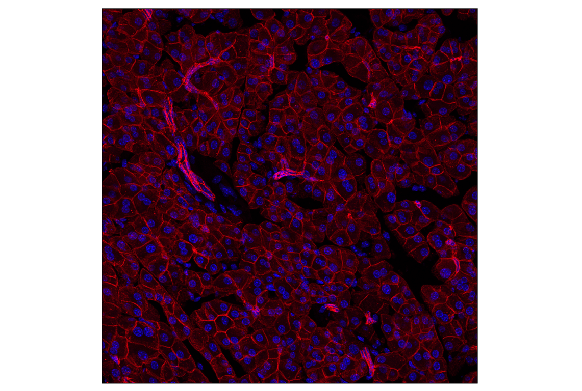 Immunofluorescence Image 2: E-Cadherin (24E10) Rabbit mAb (Alexa Fluor<sup>®</sup> 594 Conjugate)