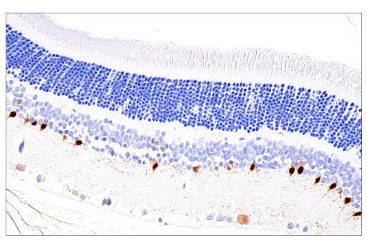 Immunohistochemistry Image 9: Parvalbumin (E8N2U) XP<sup>®</sup> Rabbit mAb
