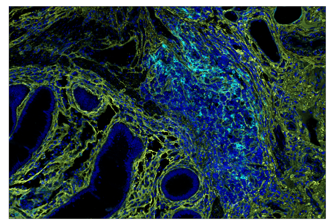 Immunohistochemistry Image 2: CD40 (D8W3N) & CO-0115-647 SignalStar<sup>™</sup> Oligo-Antibody Pair