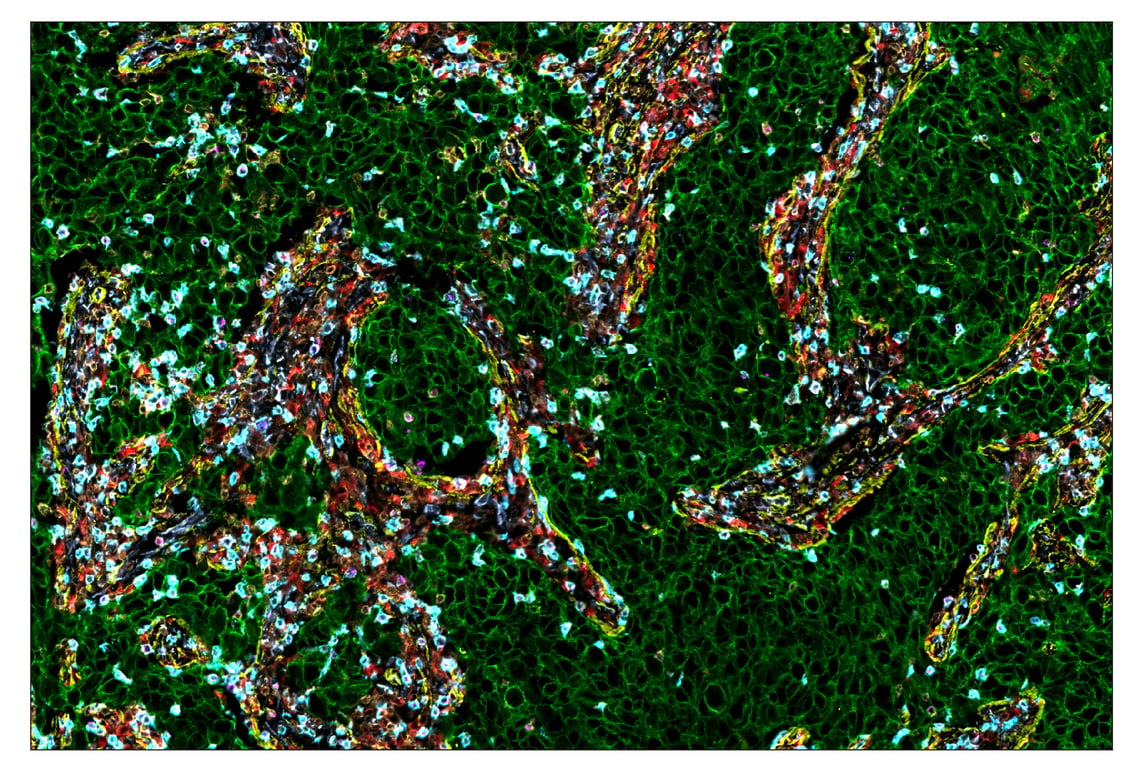 Immunohistochemistry Image 1: CD68 (D4B9C) & CO-0007-594 SignalStar<sup>™</sup> Oligo-Antibody Pair