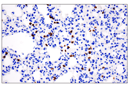 Immunohistochemistry Image 1: CD3ε (E4T1B) XP<sup>®</sup> Rabbit mAb (BSA and Azide Free)