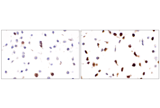 Immunohistochemistry Image 9: Cyclin A2 (E6D1J) XP<sup>®</sup> Rabbit mAb