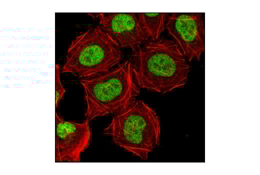 Immunofluorescence Image 1: CDK9 (C12F7) Rabbit mAb (BSA and Azide Free)
