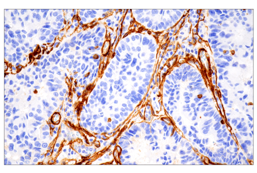 Immunohistochemistry Image 1: Integrin α1/CD49a (E9K2J) XP<sup>®</sup> Rabbit mAb (BSA and Azide Free)