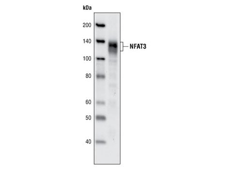 Western Blotting Image 1: NFAT3 (31G6) Rabbit mAb