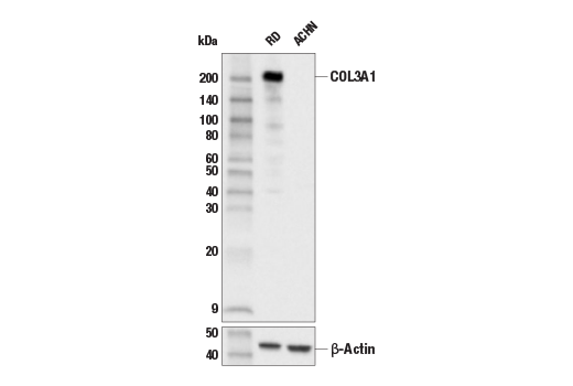 Western Blotting Image 1: COL3A1 (E8D7R) XP<sup>®</sup> Rabbit mAb (BSA and Azide Free)