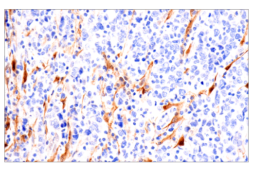 Immunohistochemistry Image 3: NNMT (E6N2Z) XP<sup>®</sup> Rabbit mAb