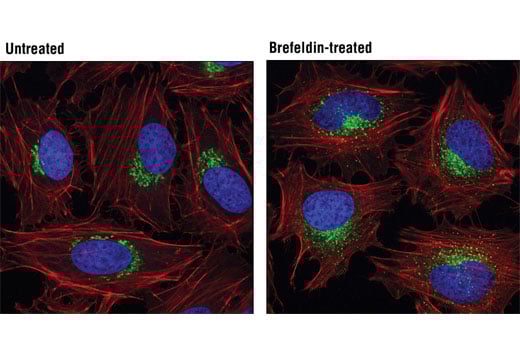 Immunofluorescence Image 1: GM130 (D6B1) XP<sup>®</sup> Rabbit mAb