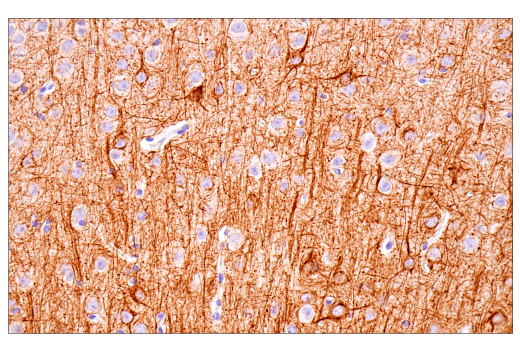 Immunohistochemistry Image 5: Neurofilament-M (E7L2T) Rabbit mAb