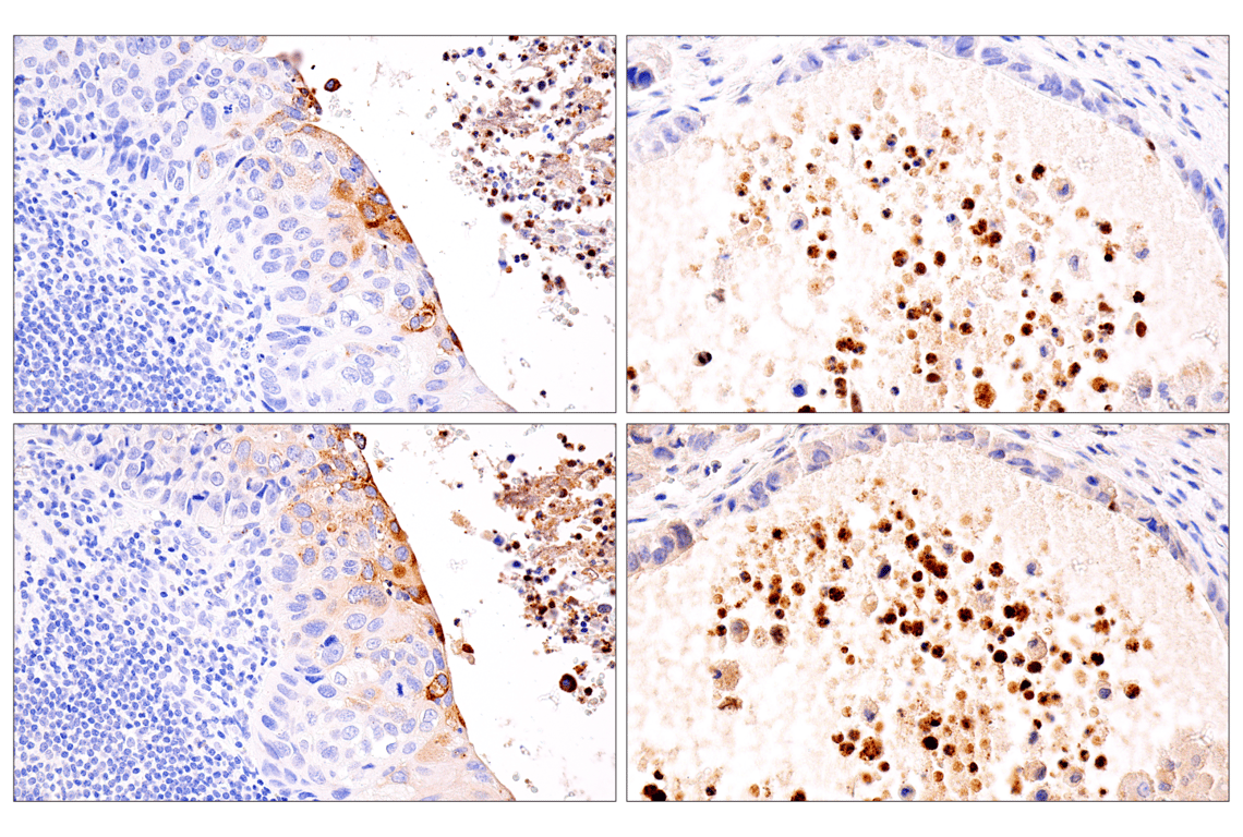 Immunohistochemistry Image 4: IL-8 (E5F5Q) XP<sup>®</sup> Rabbit mAb (BSA and Azide Free)