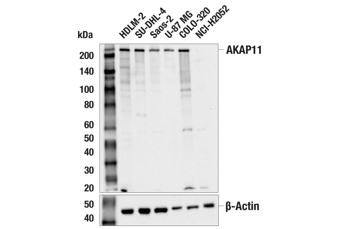 Western Blotting Image 1: AKAP11 (E9E6W) Rabbit mAb