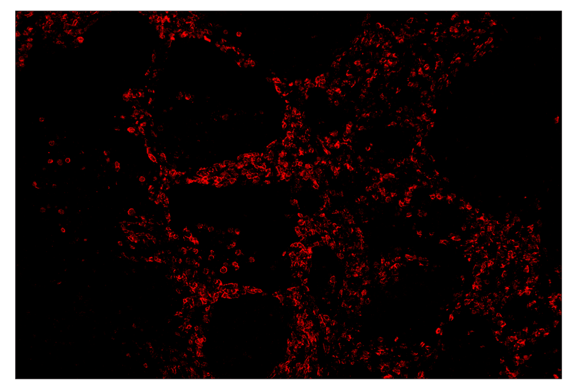 Immunohistochemistry Image 3: CD19 (Intracellular Domain) (D4V4B) & CO-0054-594 SignalStar<sup>™</sup> Oligo-Antibody Pair