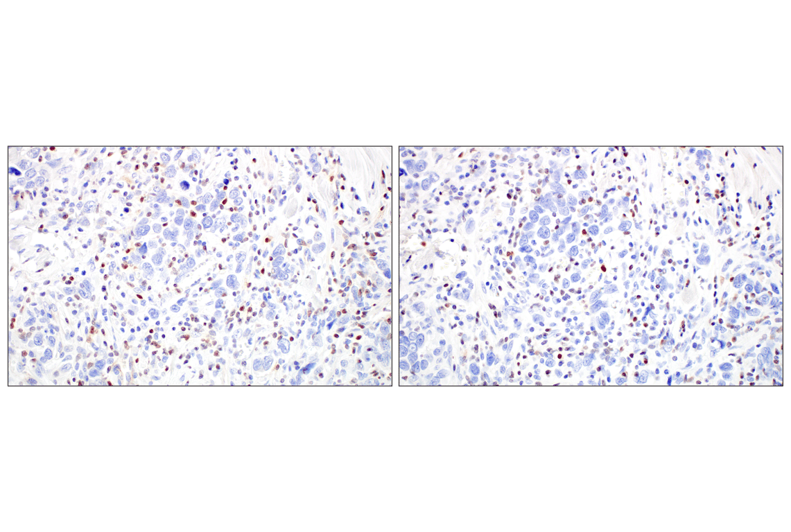 Immunohistochemistry Image 11: T-bet/TBX21 (E4I2K) Rabbit mAb